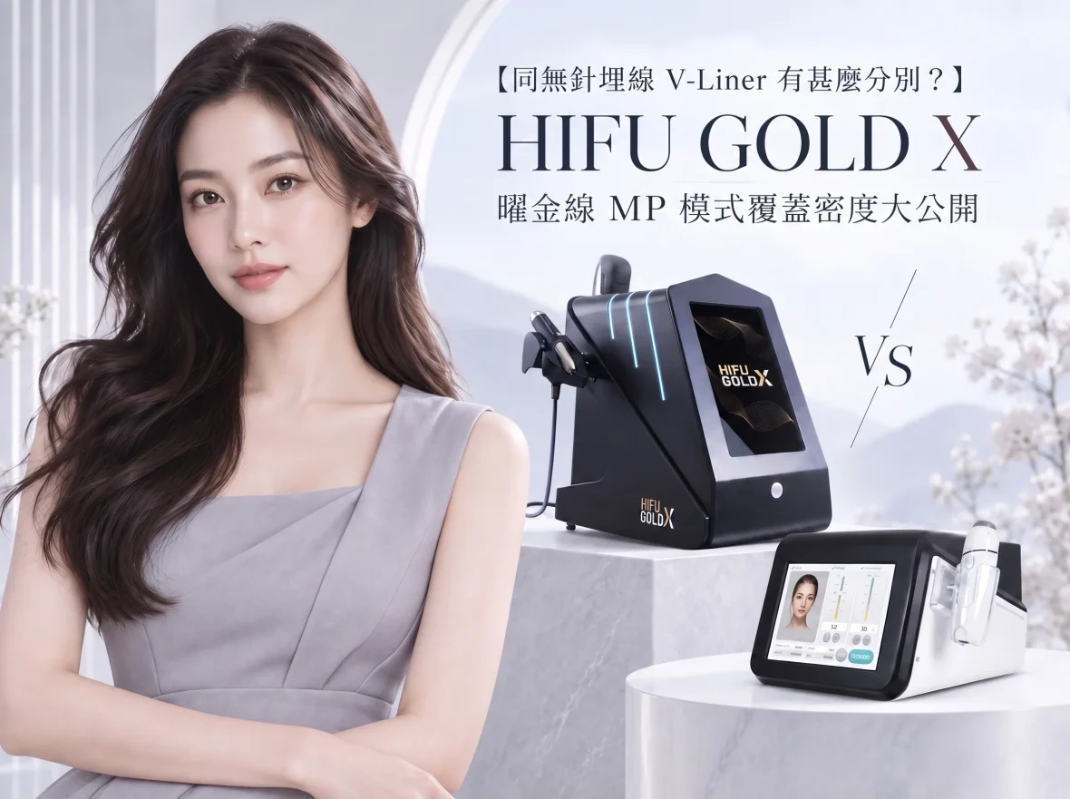 【同無針埋線 V-Liner 有甚麼分別？】HIFU GOLD X 曜金線 MP 模式覆蓋密度大公開